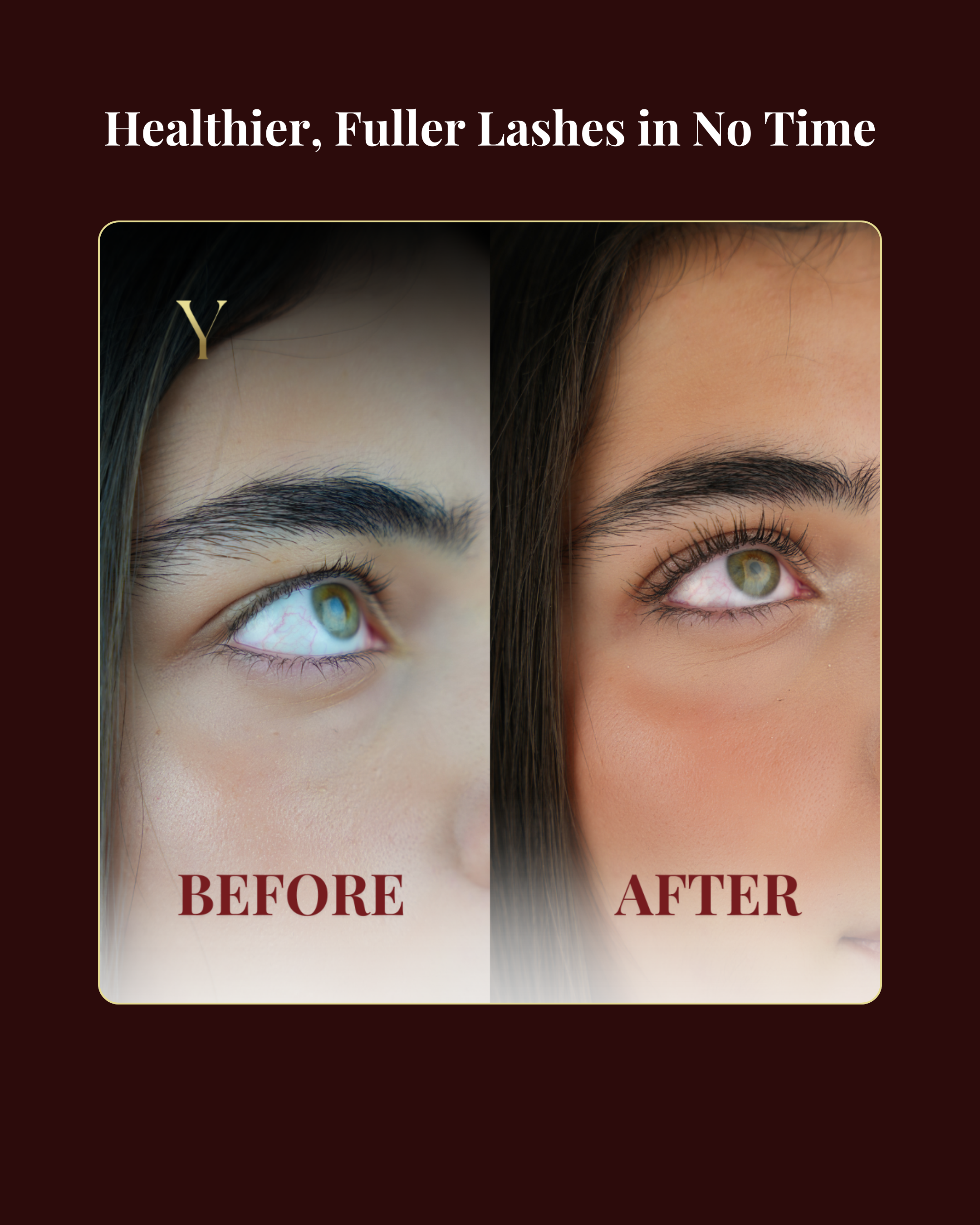 Before After Yaloré Aura Lash Serum